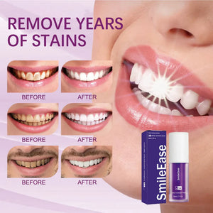 Hismile Teeth Whitening Colour Corrector Serum