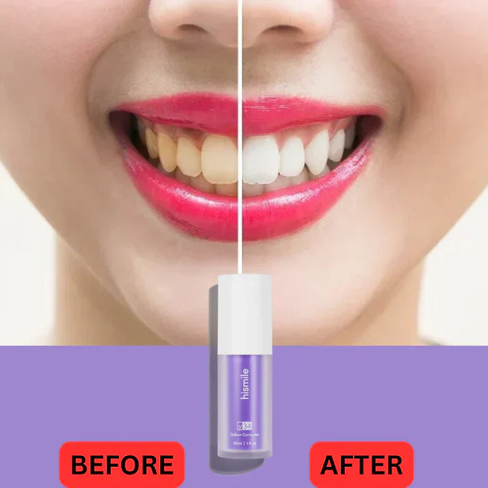 Hismile Teeth Whitening Colour Corrector Serum