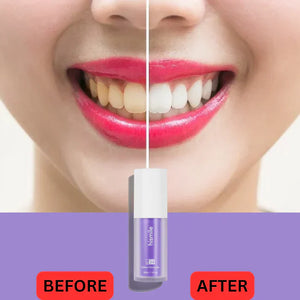 Hismile Teeth Whitening Colour Corrector Serum